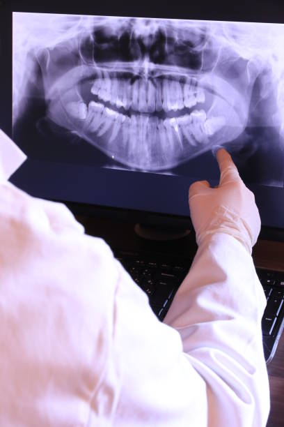 Best Emergency Tooth Extraction in St Gabriel, LA